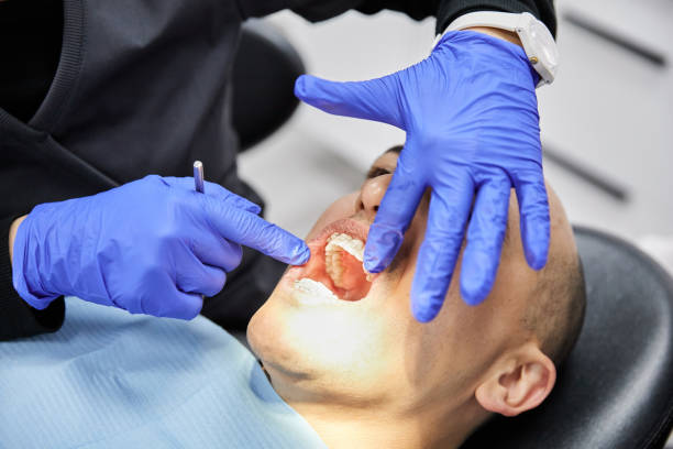 Best Urgent Care for Lost Fillings or Crowns in Durango, CO